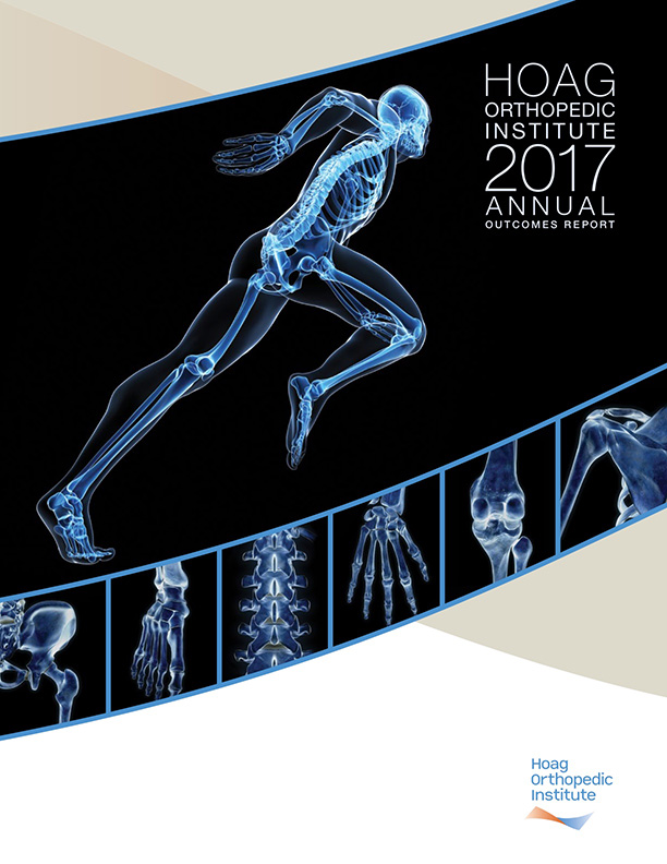 Hoag Orthopedic Institute 2017 Outcomes Report